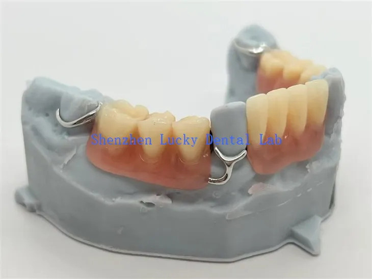 חלקי אקריליק בהדפסת תלת מימד עם סוגר T-