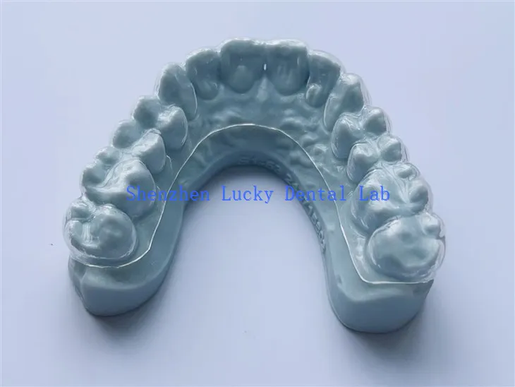 מעבדת שיניים של מגש הלבנה תלת מימדי