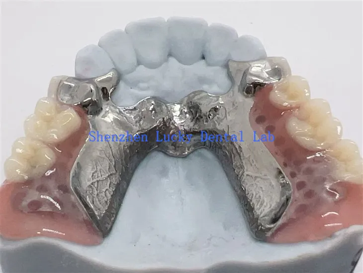 מסגרת סגסוגת טיטניום להדפסת תלת מימד