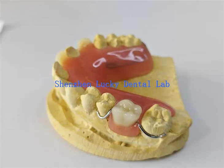 מעבדת שיניים תותבת חוט נוחה