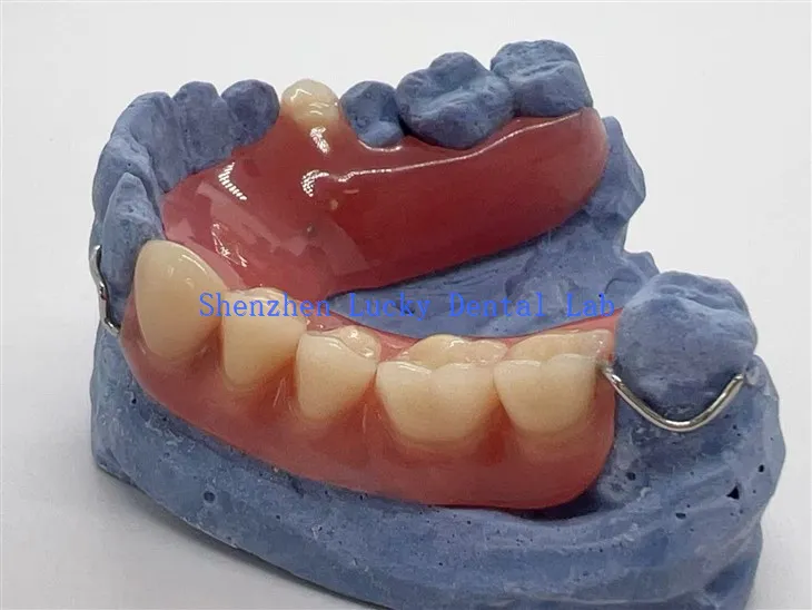 תותבת אקרילית חלקית נוחה עם אבזם תיל