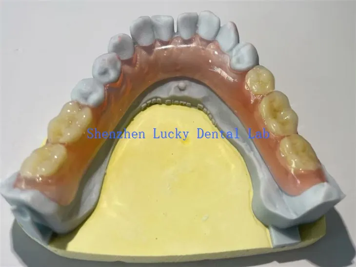 יצרני תותבות שיניים גמישות חלקיות נוחות