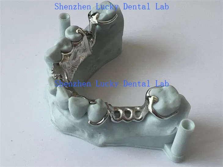 מסגרת מתכת תלת מימדית עם מעבדת שיניים של צלחת לשוני