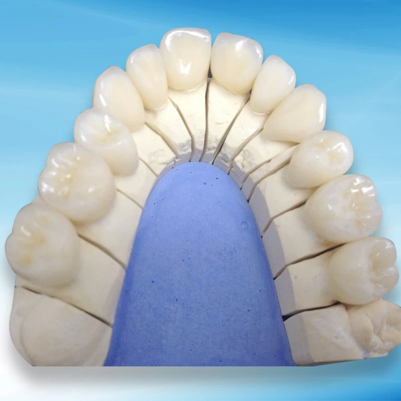 דנטל זירקוניה מכל פורצלן עם שקיפות טובה