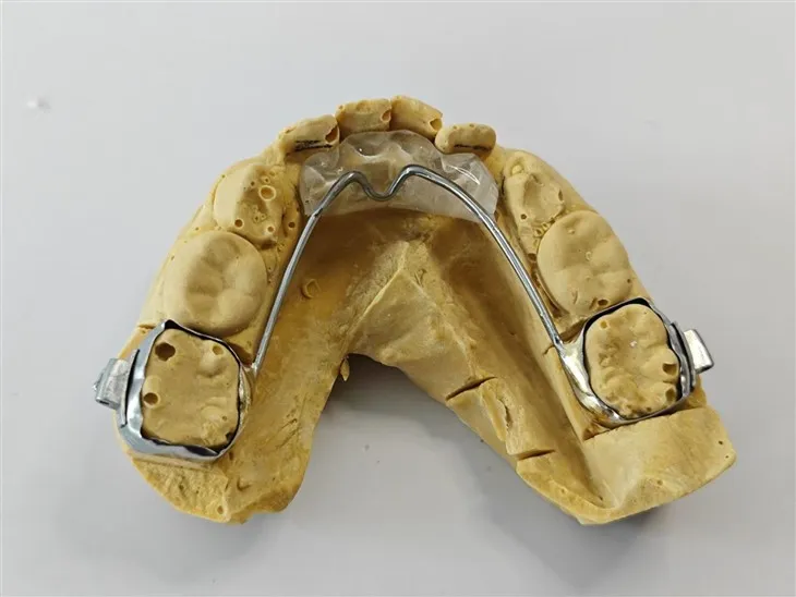 מטוס נשיכה קדמי שיניים