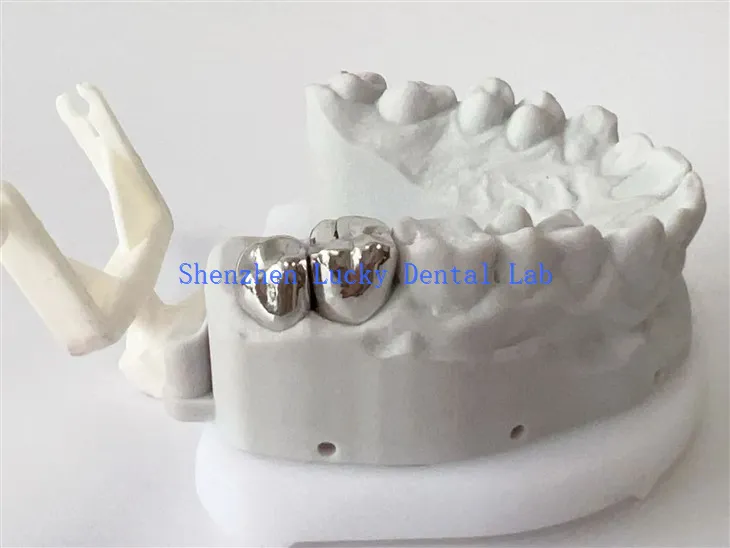 כתר מתכת מלא באיכות גבוהה