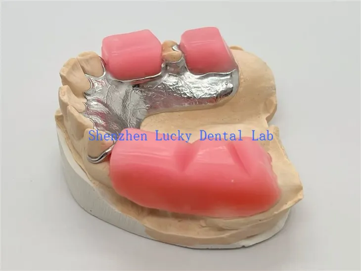 מסגרת מתכת עם בלוק נשיכה